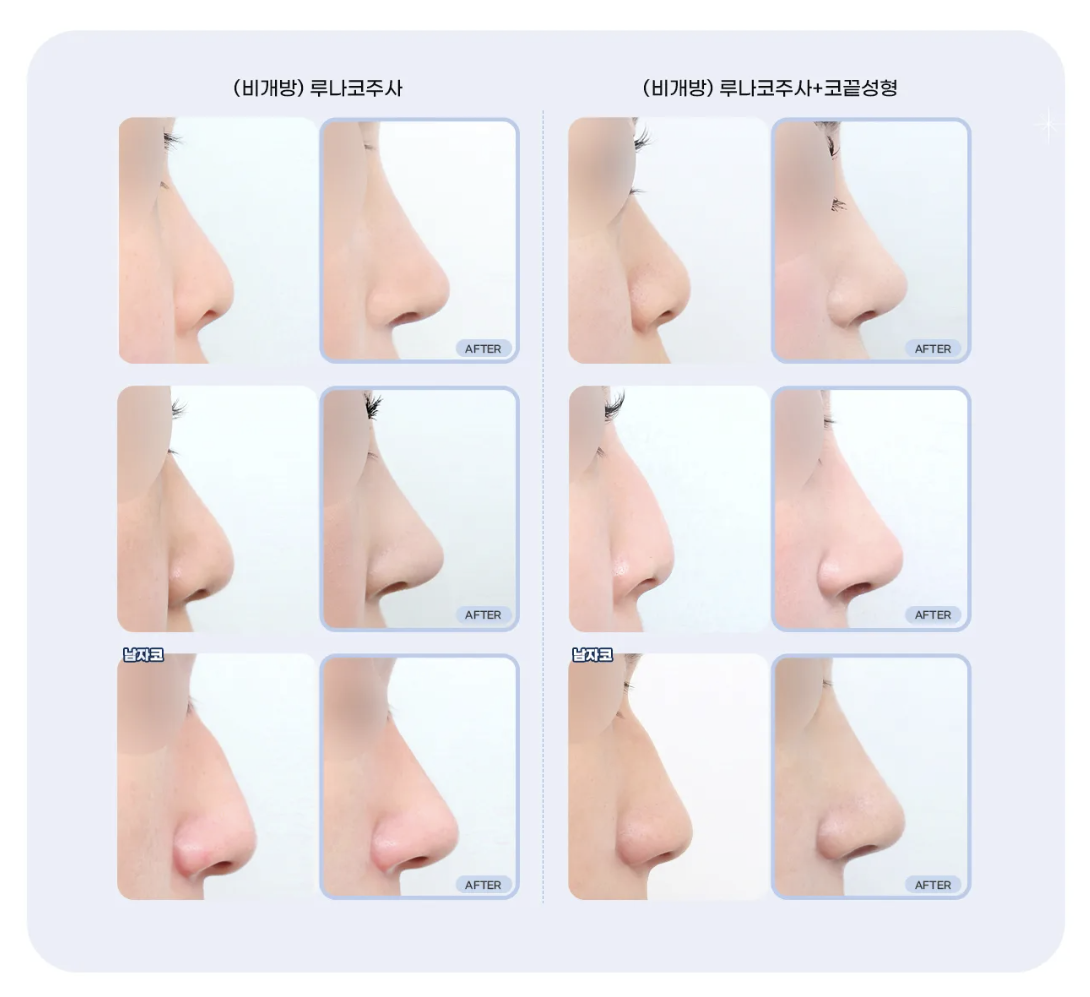 스크린샷 2026-08-27 오후 1.16.00.png