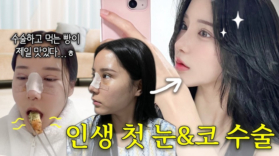 마블성형외과 리얼모델 모집