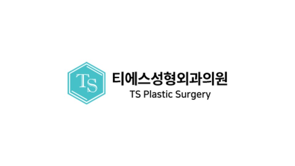 티에스성형외과 리얼모델 모집